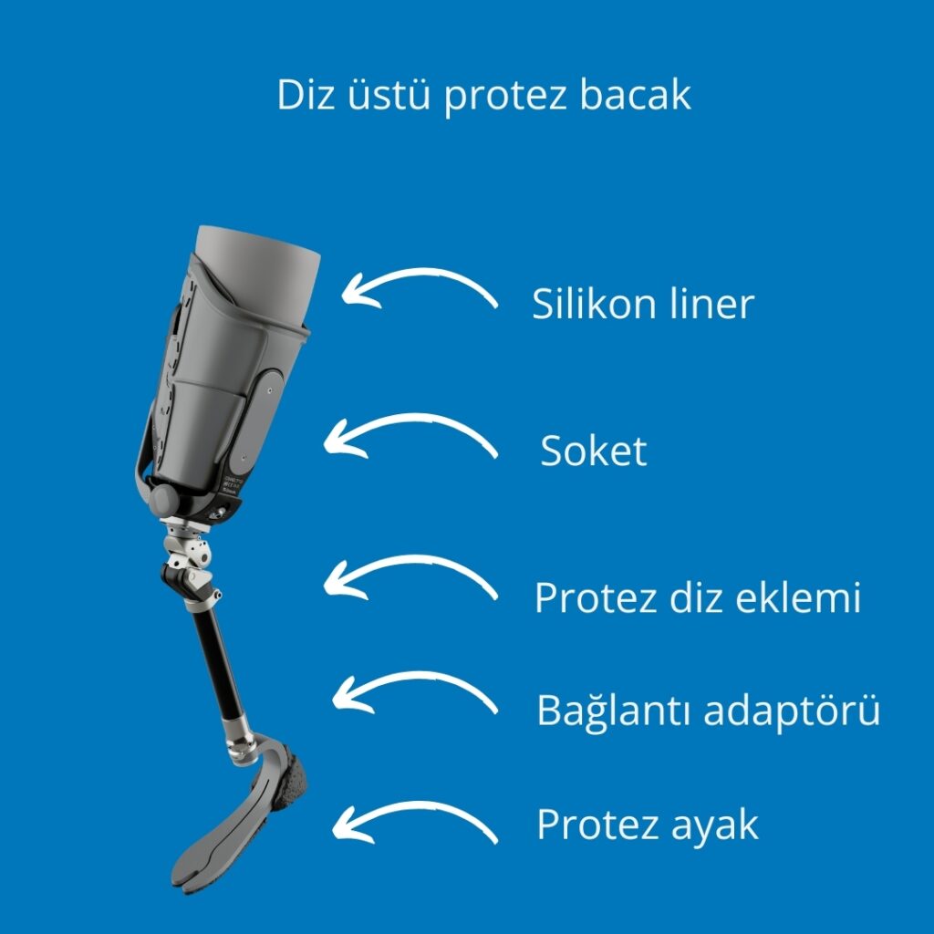 DİZ ÜSTÜ PROTEZ