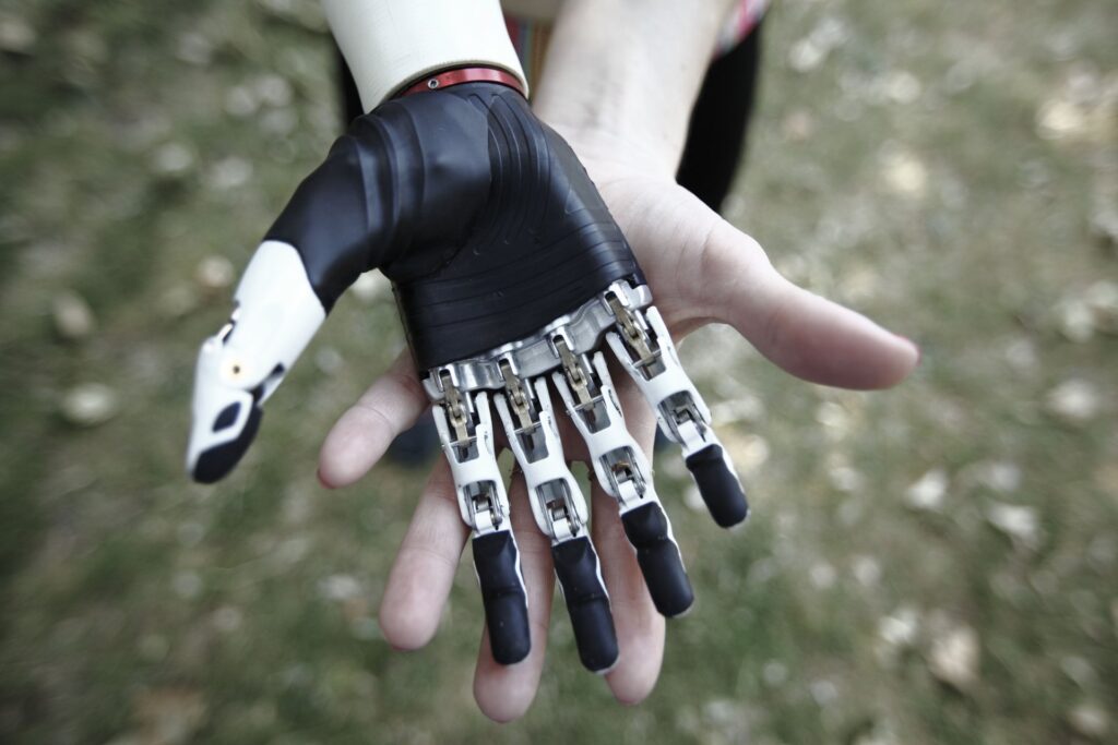bionic kol protezi